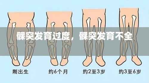 髁突发育过度，髁突发育不全 