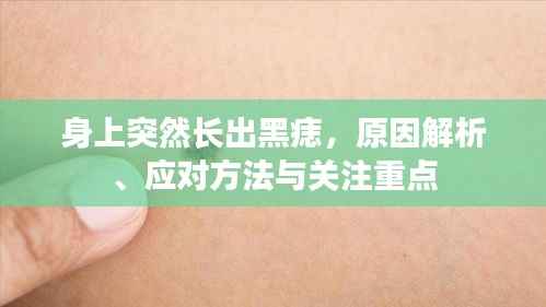 身上突然长出黑痣，原因解析、应对方法与关注重点