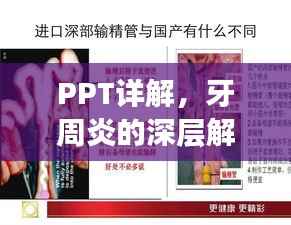 PPT详解，牙周炎的深层解析与细节探索