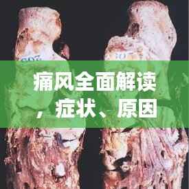 痛风全面解读，症状、原因、影响与治疗，一站式了解痛风相关知识！