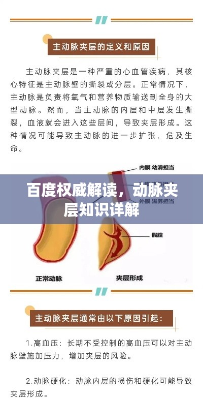 百度权威解读，动脉夹层知识详解